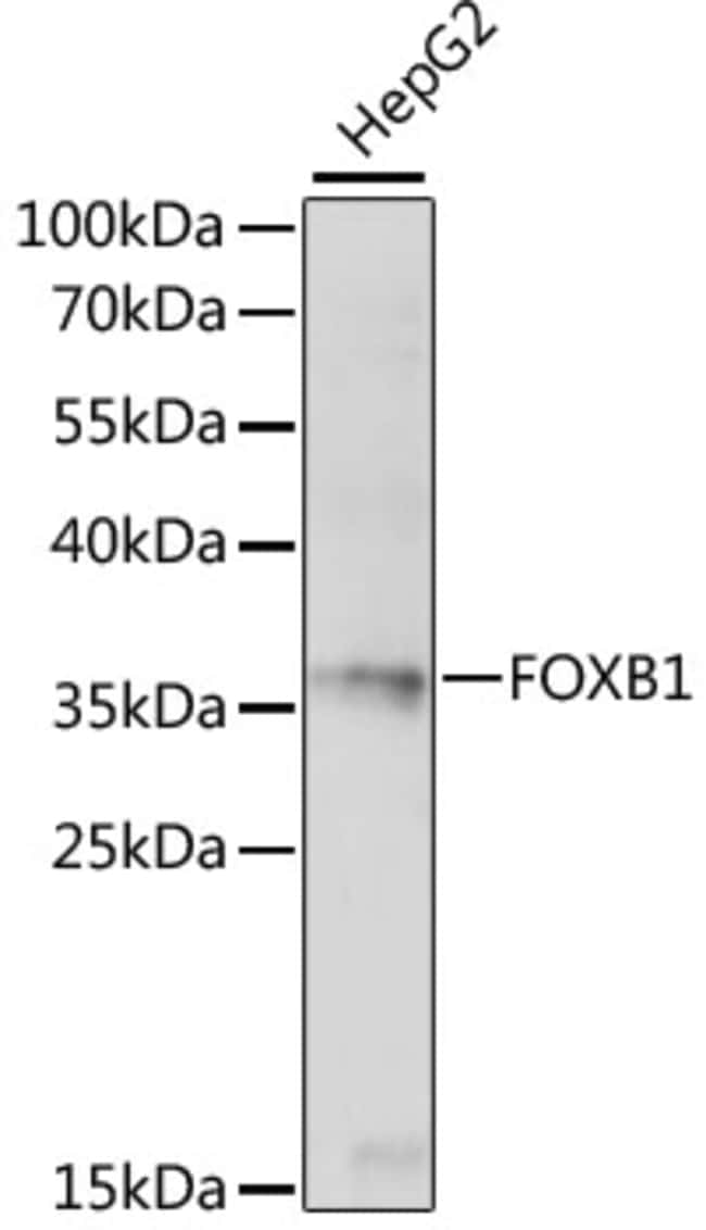 100UL FOXB1 ANTIBODY 100 ul