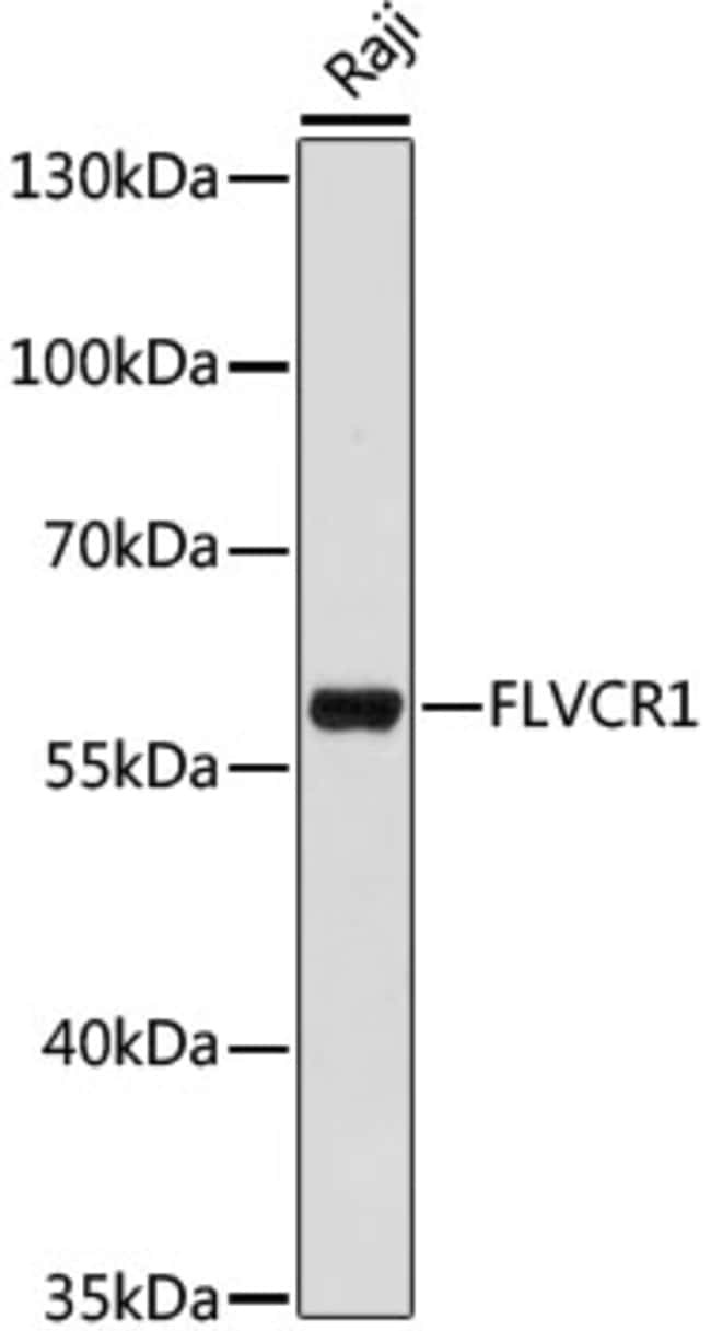 100UL FLVCR1 ANTIBODY 100 ul