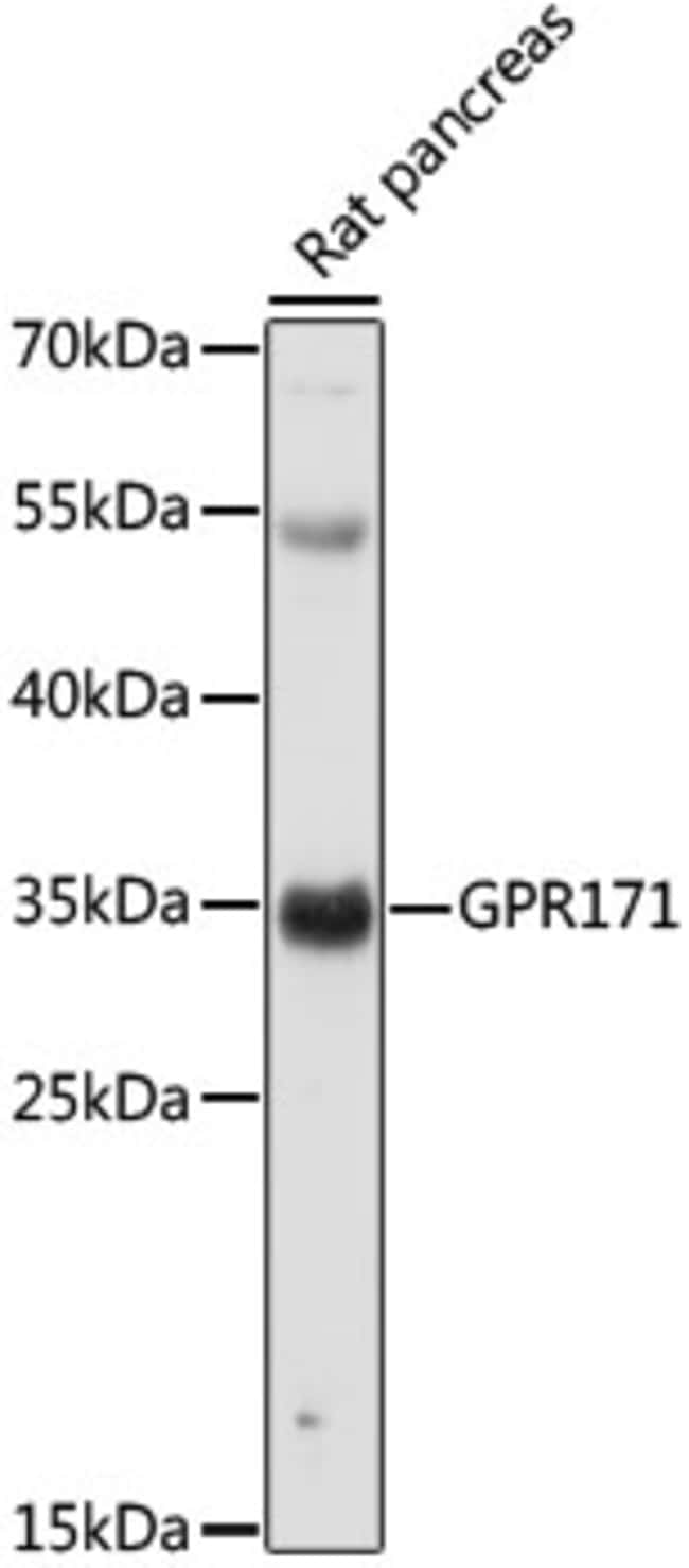 100UL GPR171 ANTIBODY 100 ul