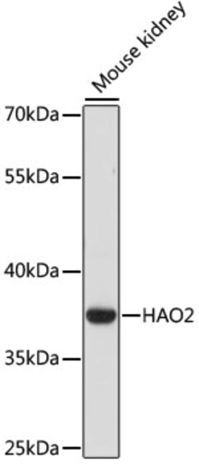 100UL HAO2 ANTIBODY 100 ul