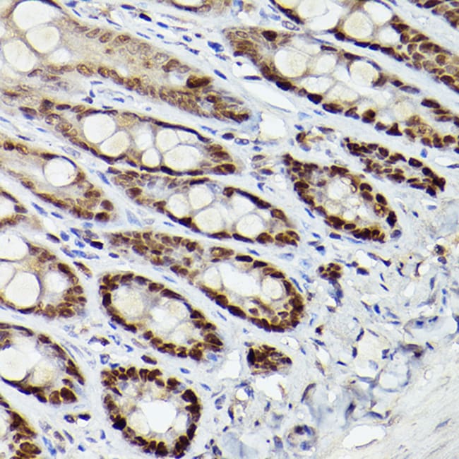 100UL HDAC9 ANTIBODY 100 ul