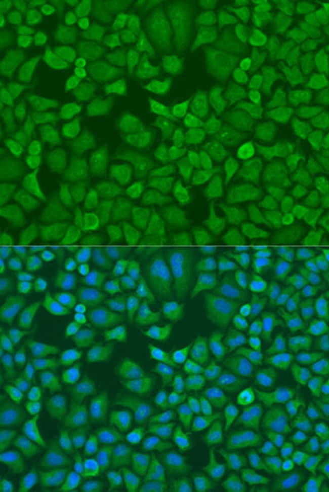 100UL IGF2BP1 ANTIBODY 100 ul