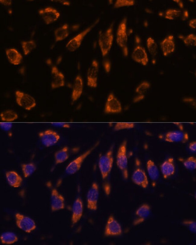 100UL CRELD1 ANTIBODY 100 ul