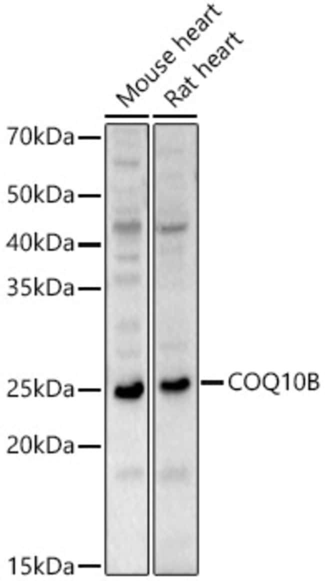 100UL COQ10B ANTIBODY 100 ul