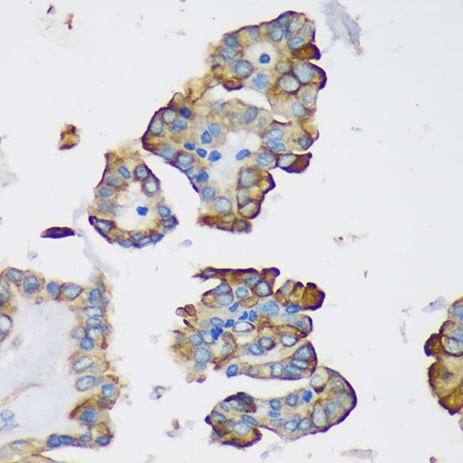 100UL DYNLRB1 ANTIBODY 100 ul