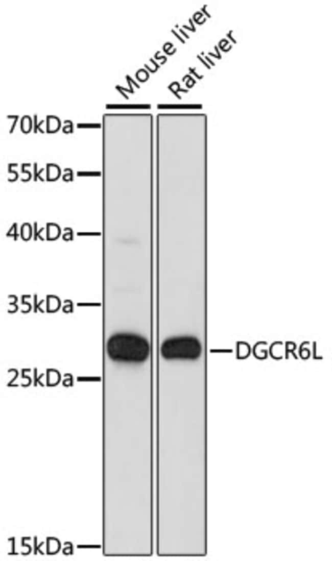 100UL DGCR6L ANTIBODY 100 ul