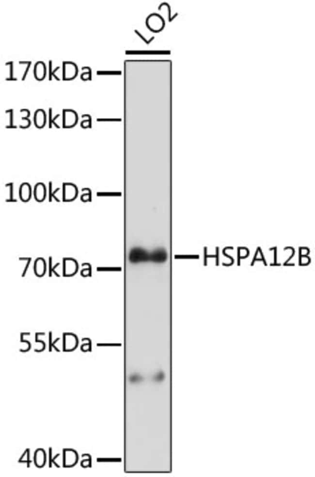 100UL HSPA12B ANTIBODY 100 ul