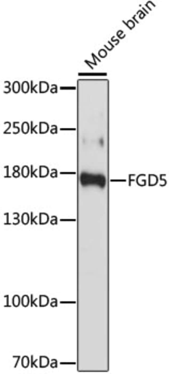 100UL FGD5 ANTIBODY 100 ul