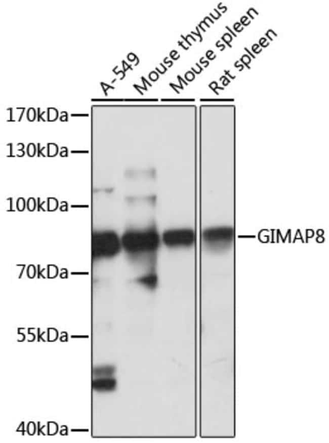 100UL GIMAP8 ANTIBODY 100 ul