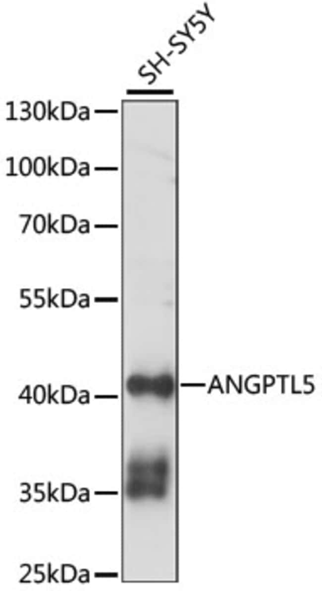 100UL ANGPTL5 ANTIBODY 100 ul