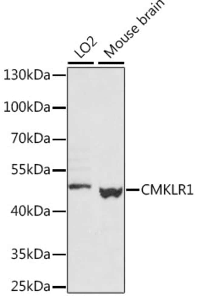 100UL CMKLR1 ANTIBODY 100 ul