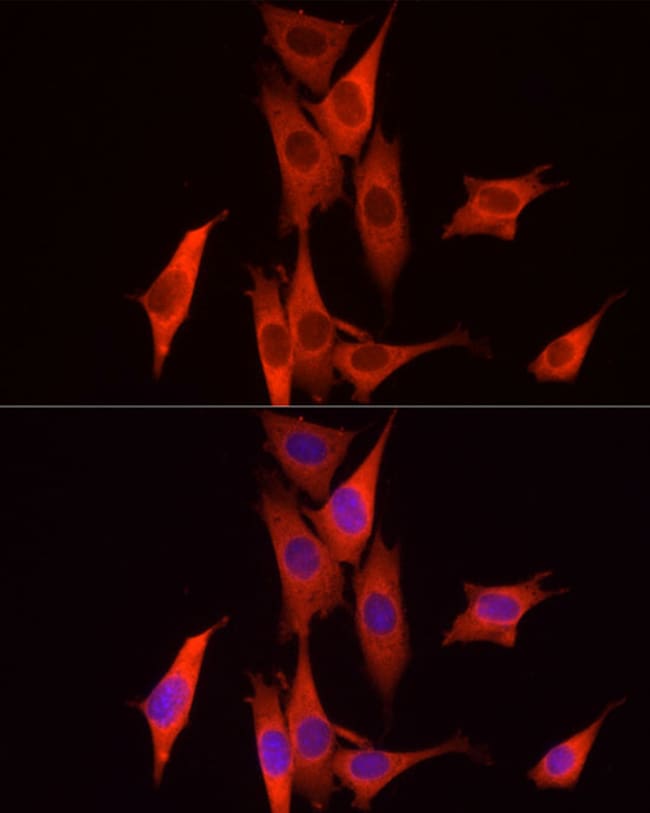 100UL CASPASE 7 P11 ANTIBODY 100 ul