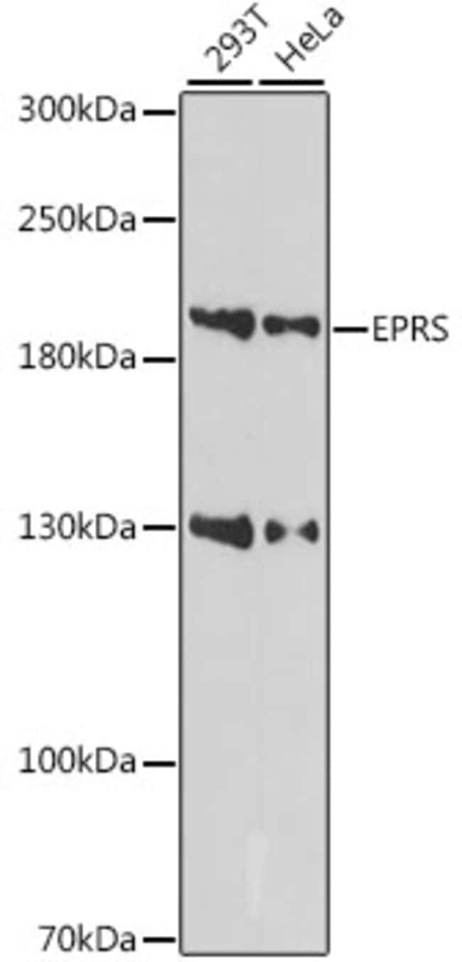 100UL EPRS ANTIBODY 100 ul