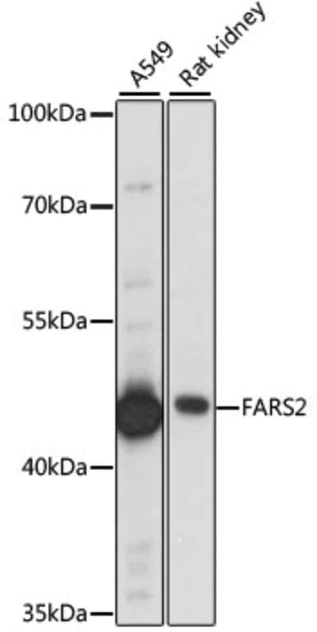 100UL FARS2 ANTIBODY 100 ul