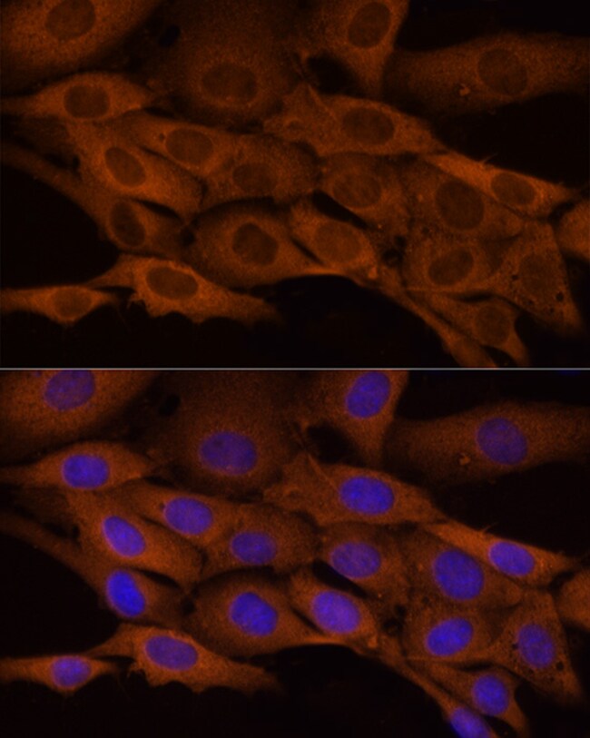 100UL ATP CITRATE LYASE ANTIBODY 100 ul