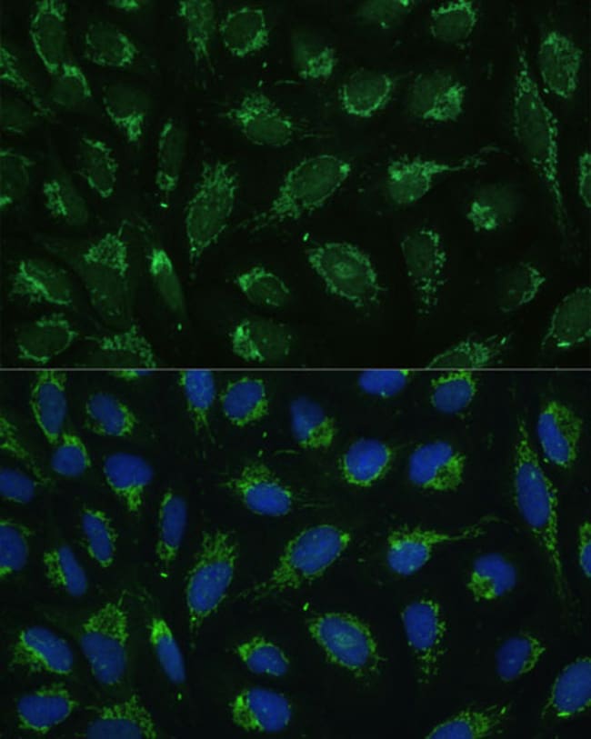 100UL ATP SYNTHASE GAMMA ANTIBODY 100 ul
