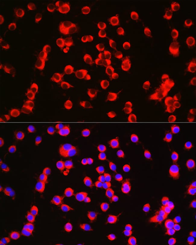 100UL ALPHA CATENIN ANTIBODY 100 ul