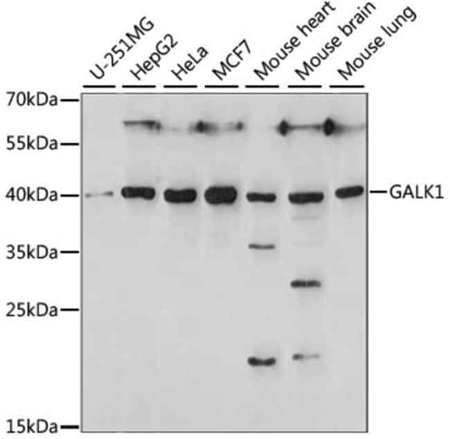 100UL GALK1 ANTIBODY 100 ul