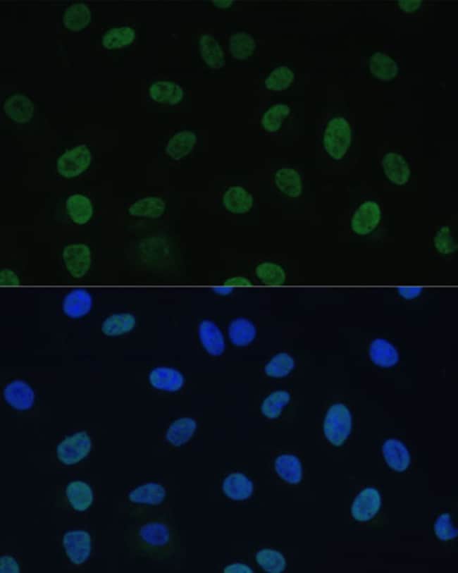 100UL GTF2E1 ANTIBODY 100 ul