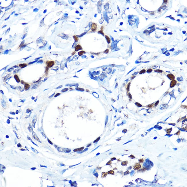 100UL FOXA1 ANTIBODY 100 ul