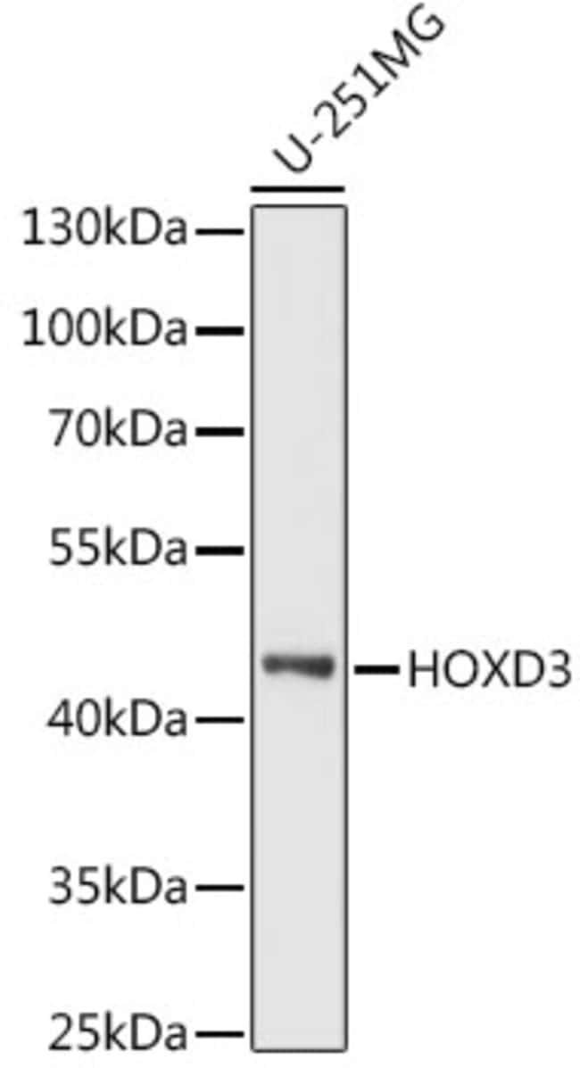100UL HOXD3 ANTIBODY 100 ul