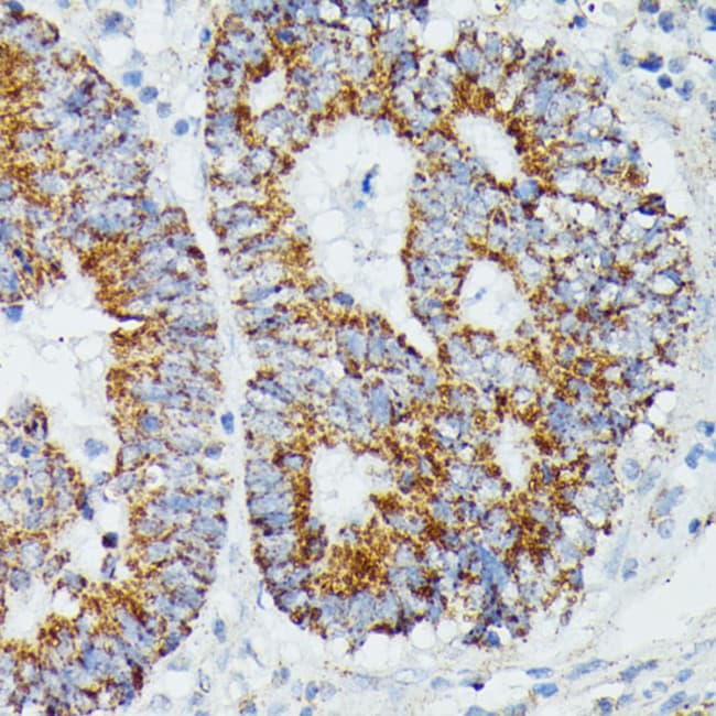 100UL IVD ANTIBODY 100 ul