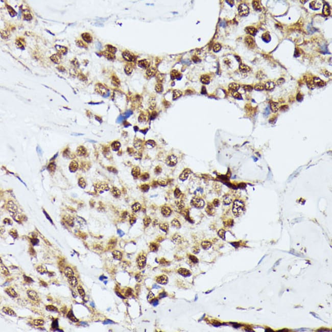 100UL KID ANTIBODY 100 ul