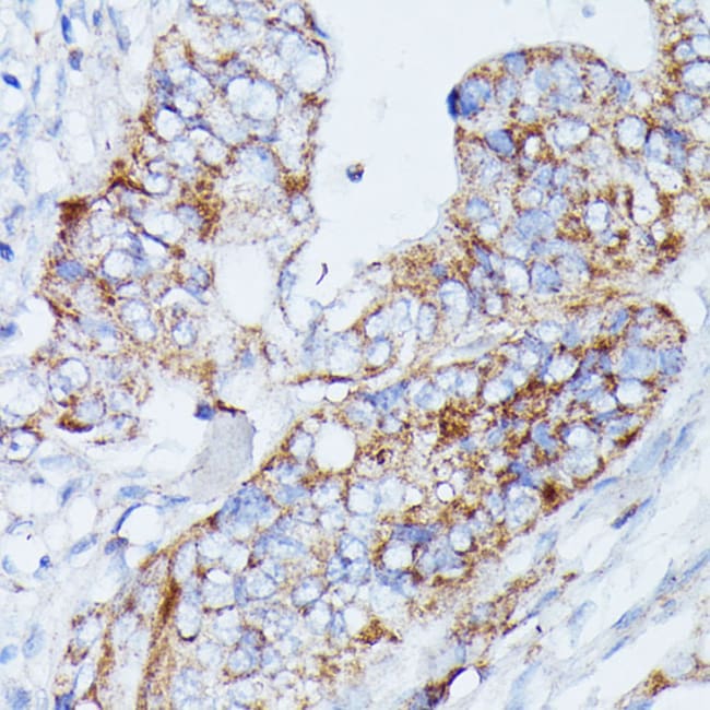 100UL MANBA ANTIBODY 100 ul
