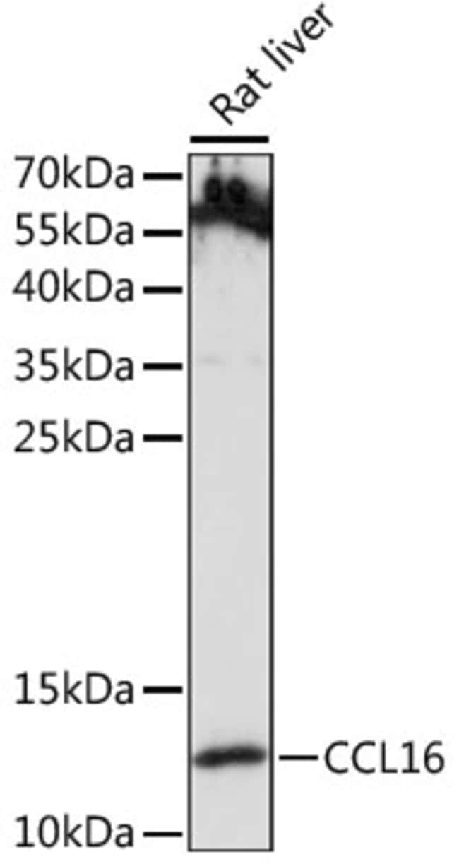 100UL CCL16 ANTIBODY 100 ul