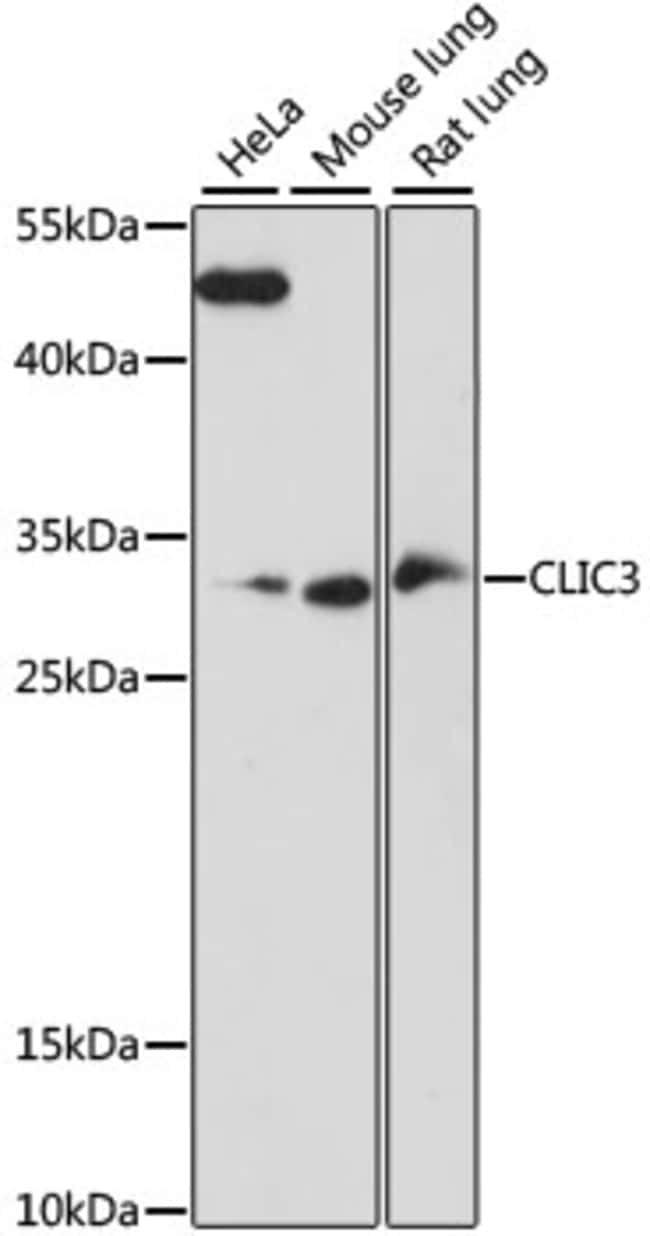 100UL CLIC3 ANTIBODY 100 ul