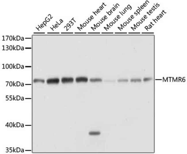 100UL MTMR6 ANTIBODY 100 ul