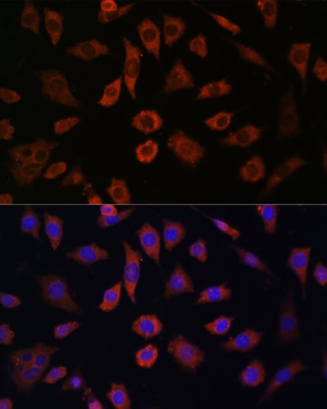 100UL CYTOHESIN 1 ANTIBODY 100 ul