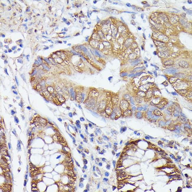 100UL ASC1 ANTIBODY 100 ul