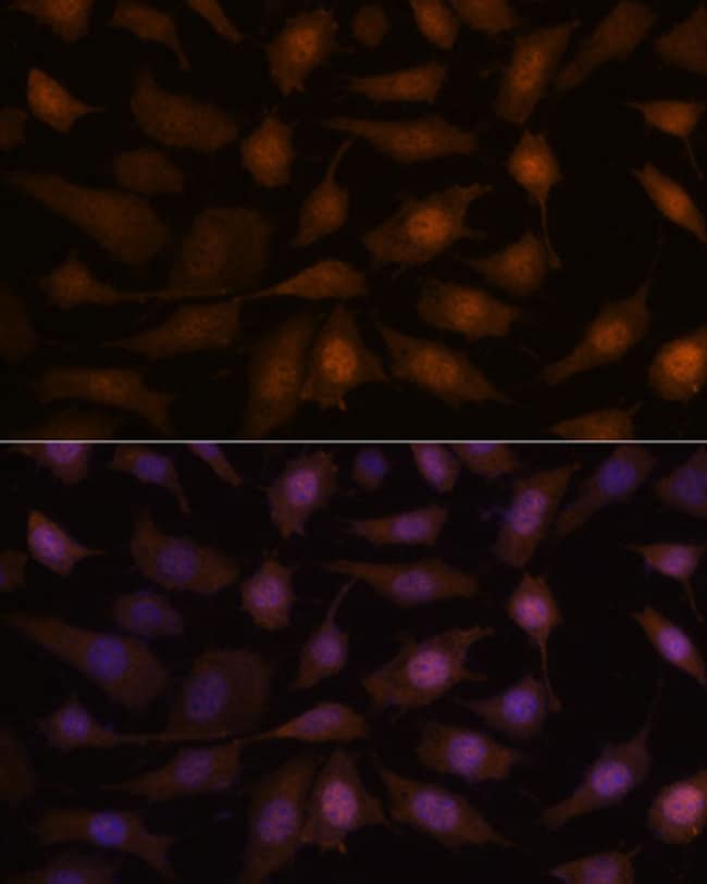 100UL EEF1E1 ANTIBODY 100 ul