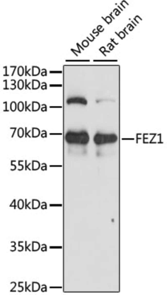 100UL FEZ1 ANTIBODY 100 ul