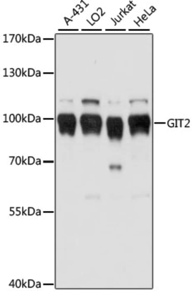 100UL GIT2 ANTIBODY 100 ul