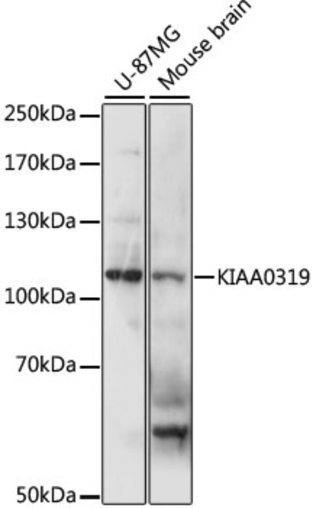 100UL KIAA0319 ANTIBODY 100 ul