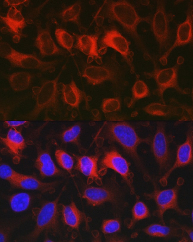 100UL G6PD ANTIBODY 100 ul