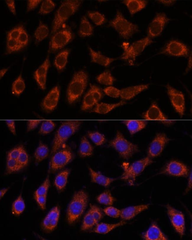 100UL GFPT2 ANTIBODY 100 ul