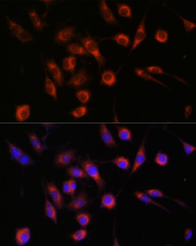 100UL CERT ANTIBODY 100 ul