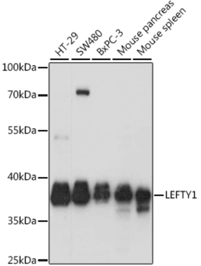 100UL LEFTY ANTIBODY 100 ul