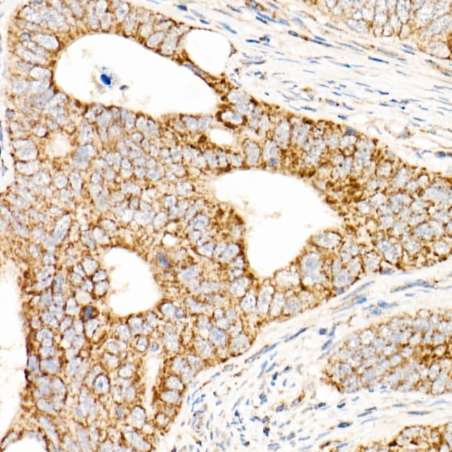 100UL AFG3L2 ANTIBODY 100 ul