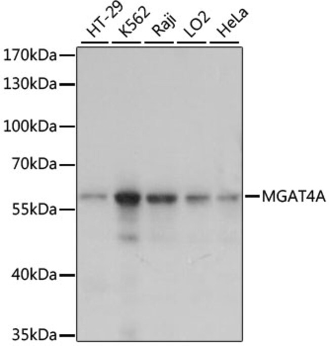 100UL MGAT4A ANTIBODY 100 ul