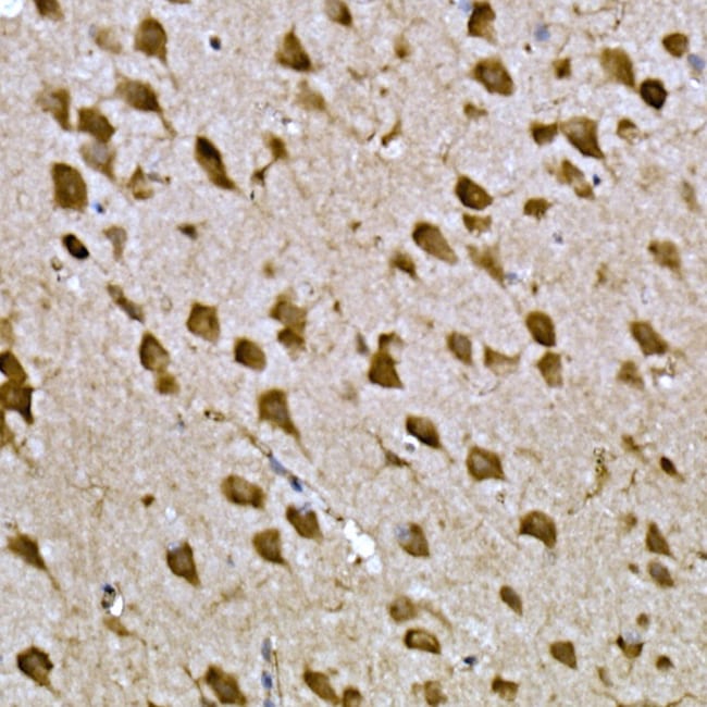 100UL CPEB3 ANTIBODY 100 ul