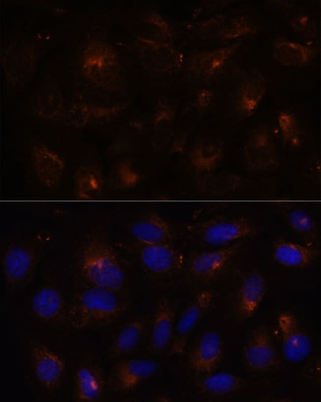 100UL FAM62A ANTIBODY 100 ul