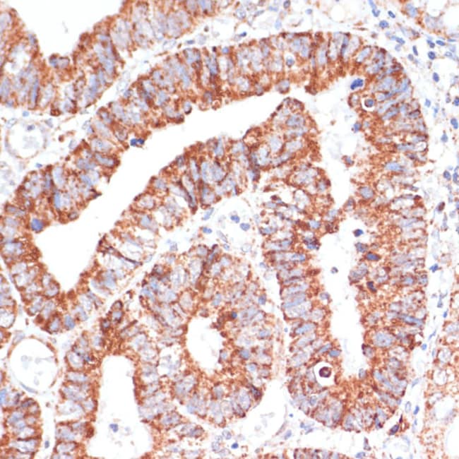 100UL MRPL46 ANTIBODY 100 ul