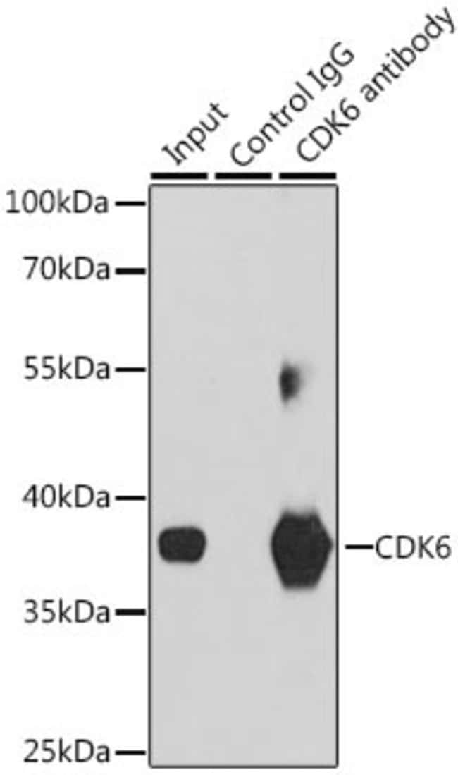 100UL CDK6 ANTIBODY 100 ul