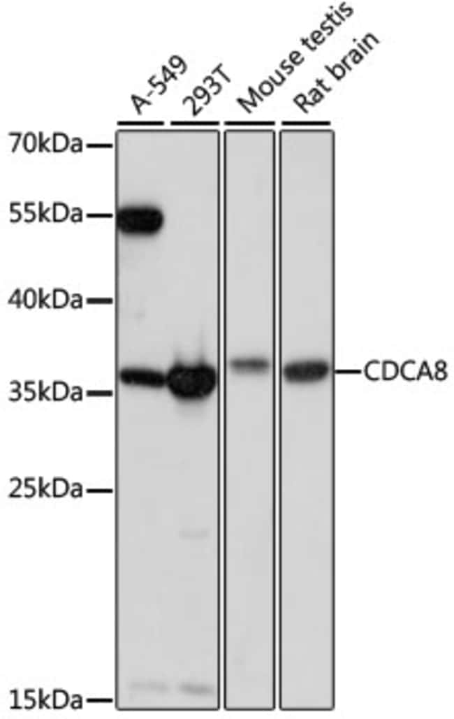 100UL CDCA8 ANTIBODY 100 ul