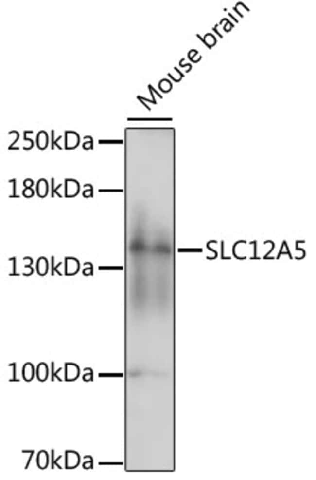 100UL KCC2 ANTIBODY 100 ul