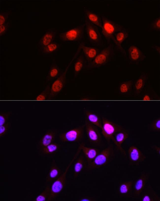 100UL HOPX ANTIBODY 100 ul
